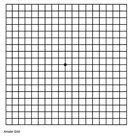 Image of an amsler grid. A grid that helps show distortion or vision abnormalities due to retina changes.