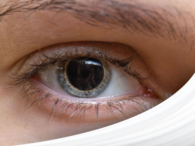 Image of a fully dilated eye during a comprehensive eye exam.